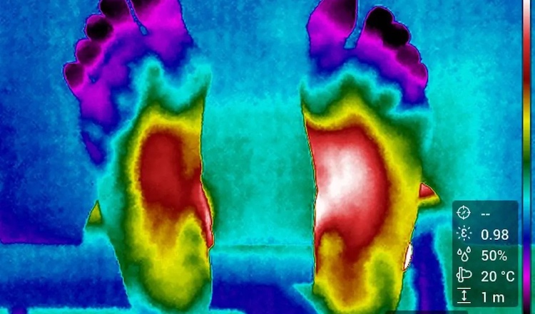 Termografia ajuda a prevenir lesões de atletas olímpicos e amadores